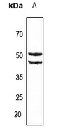 Anti-Cytochrome P450 2A6 Antibody