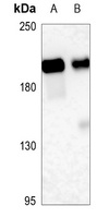 ACE antibody