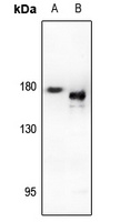 EGFR Rabbit Polyclonal Antibody