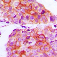 EGFR Rabbit Polyclonal Antibody