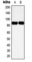 Anti-Cortactin (Phospho-Y466) Antibody