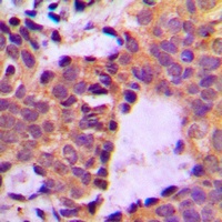 Cortactin (Phospho-Y466) Rabbit Polyclonal Antibody