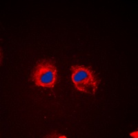 Cortactin (Phospho-Y466) Rabbit Polyclonal Antibody