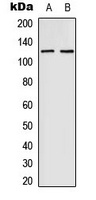 EPHB4 antibody