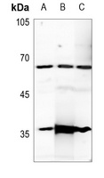 Anti-Estrogen Receptor alpha Antibody