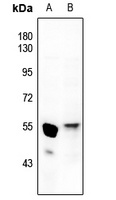 GATA4 antibody
