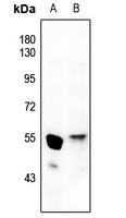 Anti-GATA4 Antibody