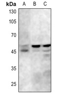 GSK3A; GSK3B antibody