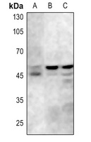 Anti-GSK3 alpha/beta (Phospho-Y279/216) Antibody