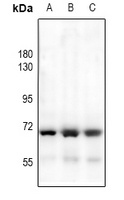 HEXB antibody