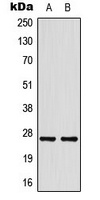 HSPB1 antibody