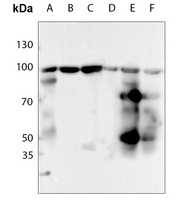 Anti-HSP90 beta (Phospho-S254) Antibody