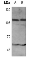 Anti-IFNAR1 (Phospho-Y466) Antibody