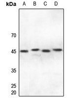 Anti-IRF4 Antibody