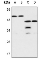 LGALS8 antibody