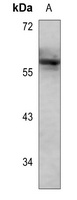 Anti-LYN (Phospho-Y508) Antibody