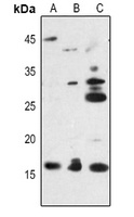 Anti-Midkine Antibody