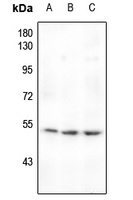 Anti-MEF2A (Phospho-T319) Antibody