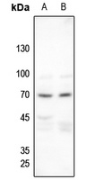 Anti-Merlin (Phospho-S518) Antibody
