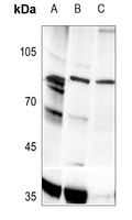 Anti-PLA2G4A (Phospho-S505) Antibody