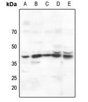 Anti-AMPK beta 1 Antibody
