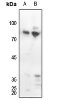 Anti-PKC delta (Phospho-Y313) Antibody
