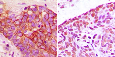 Super Sensitive IHC Detection System Kit
