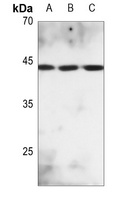 Anti-MKK2 (Phospho-T394) Antibody