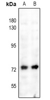 Anti-NF-kappaB p65 (Phospho-S529) Antibody