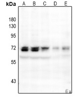 NFkB p65 (phospho-S529) antibody