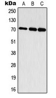 S6K1 (phospho-T444) antibody