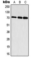 Anti-S6K1 (Phospho-T444) Antibody