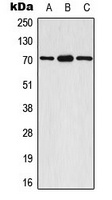Anti-S6K1 (Phospho-S447) Antibody