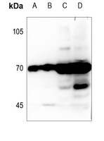Delta-NaCH antibody