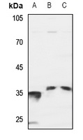 Anti-SRSF7 Antibody