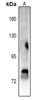 Anti-STAT4 (Phospho-Y693) Antibody