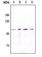 Anti-STAT6 (Phospho-Y641) Antibody