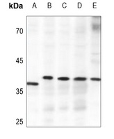 Anti-ELOVL4 Antibody