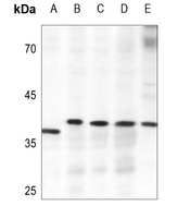 ELOVL4 antibody