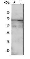 TGF beta Receptor 2 (phospho-S225) antibody