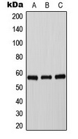 Tyrosine Hydroxylase (phospho-S71) antibody