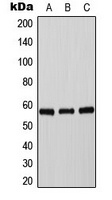 Anti-Tyrosine Hydroxylase (Phospho-S71) Antibody