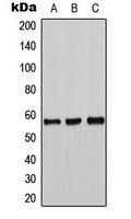 Tyrosine Hydroxylase antibody