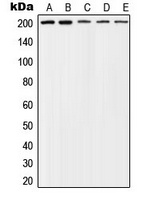 Anti-TSC2 (Phospho-T1462) Antibody