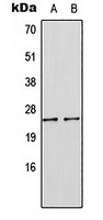 Anti-SOCS1 Antibody