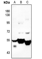CDKL2 Rabbit Polyclonal Antibody