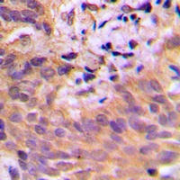 CDKL2 Rabbit Polyclonal Antibody
