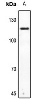 Anti-HGS Antibody