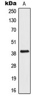 Anti-AIM2 Antibody
