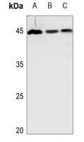 Anti-GDF15 Antibody
